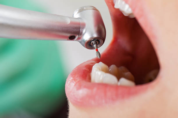 Best Emergency Dental Services for Seniors in Jackson, WY